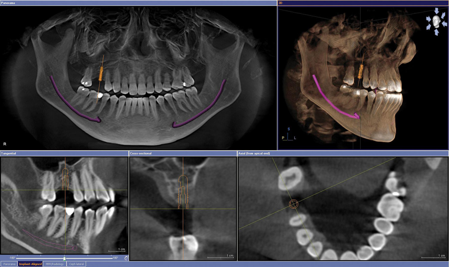 دانستنی های CBCT